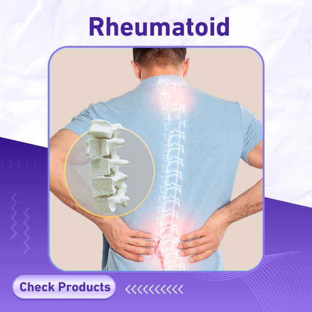 Joints Medications - Milano Pharmacy