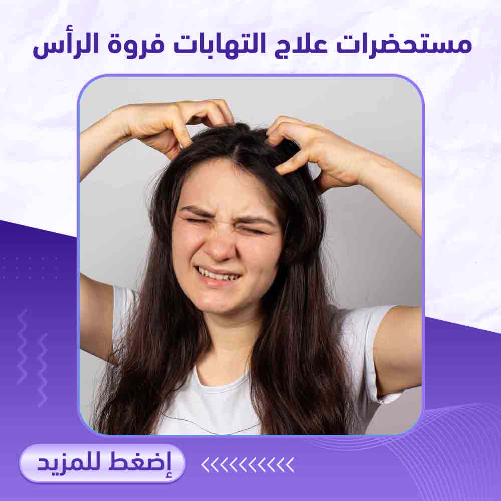 مستحضرات علاج التهابات فروة الرأس - صيدلية ميلانو