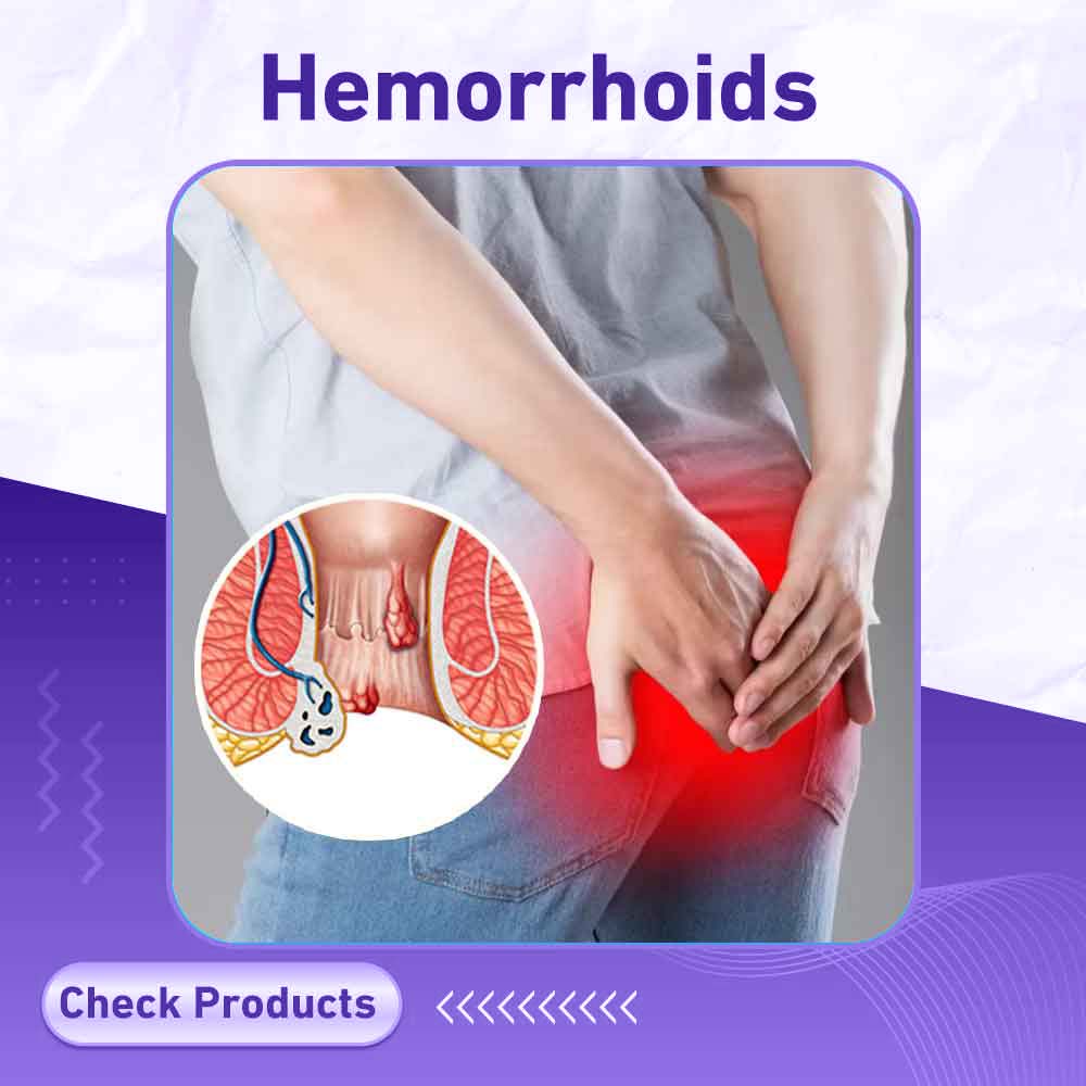 hemorrhoids - Milano Pharmacy