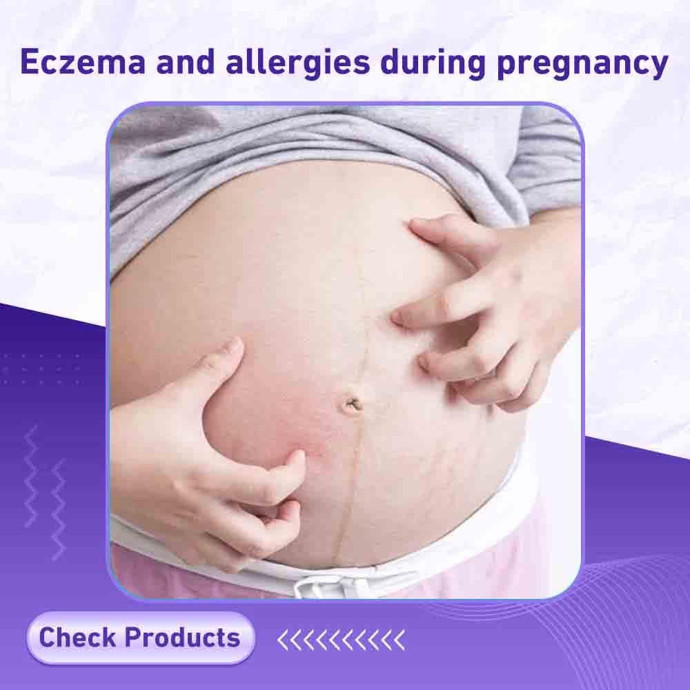 Eczema and allergies during pregnancy - Milano Pharmacy