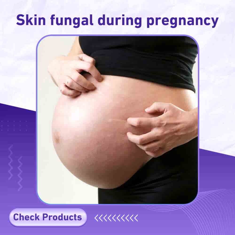 Skin fungal during pregnancy - Milano Pharmacy