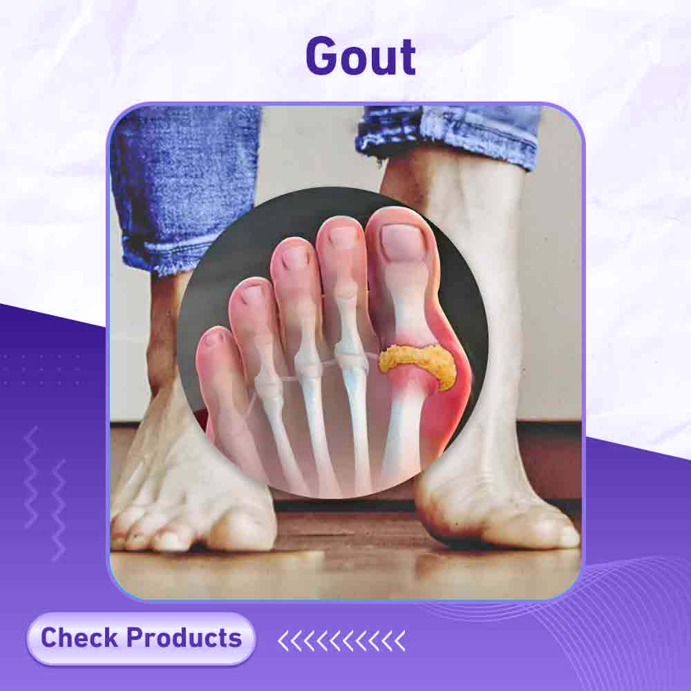 Gout Pain - Milano Pharmacy