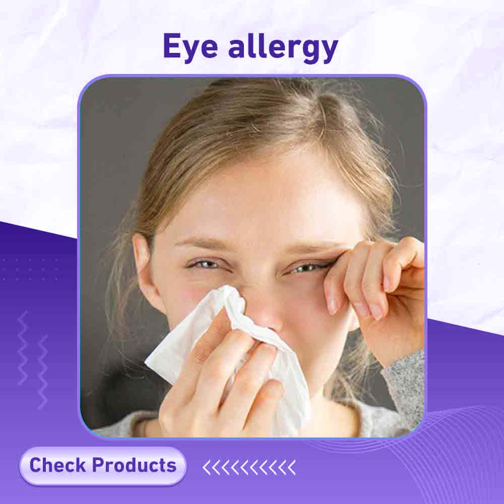 Eye allergy - Milano Pharmacy