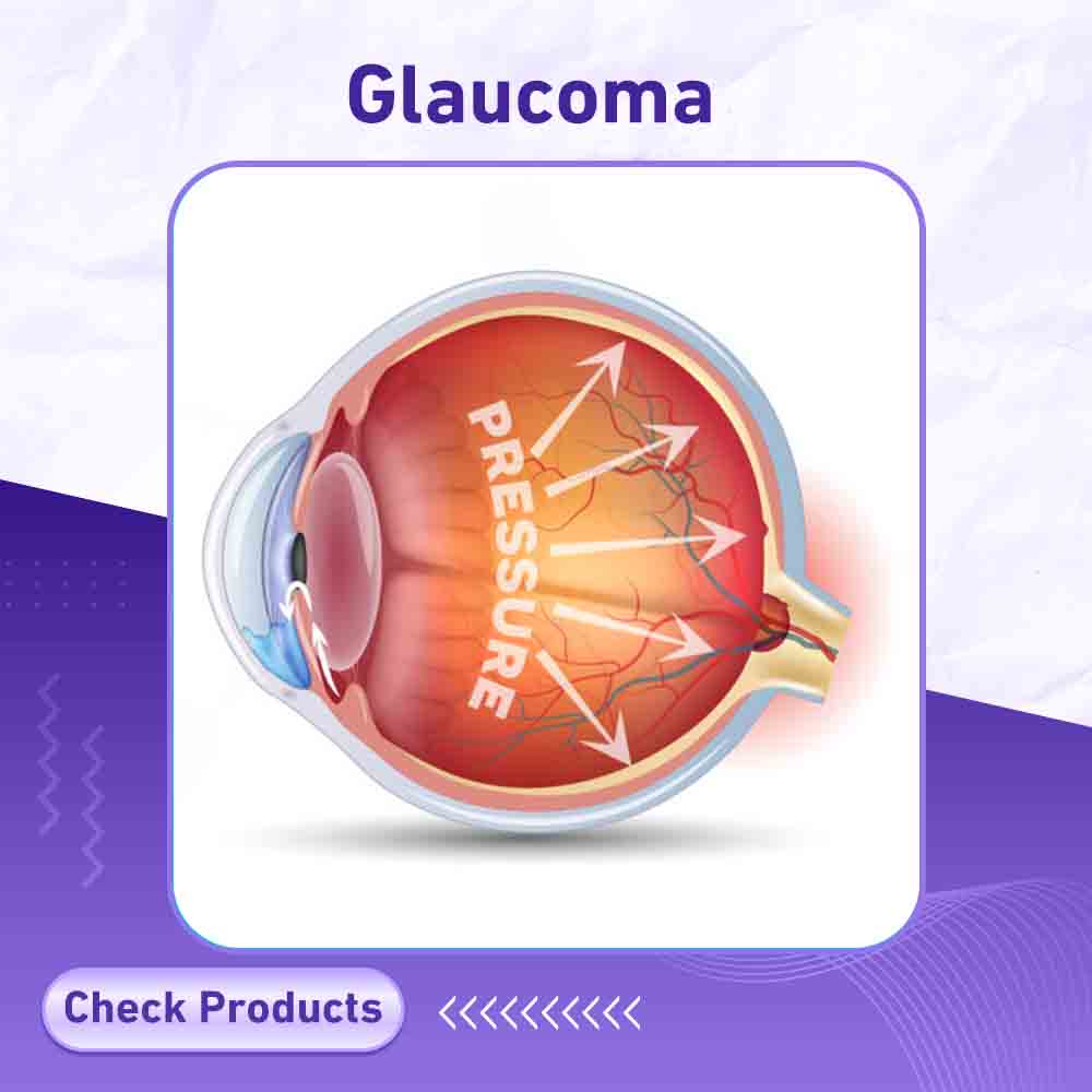 Glaucoma - Milano Pharmacy