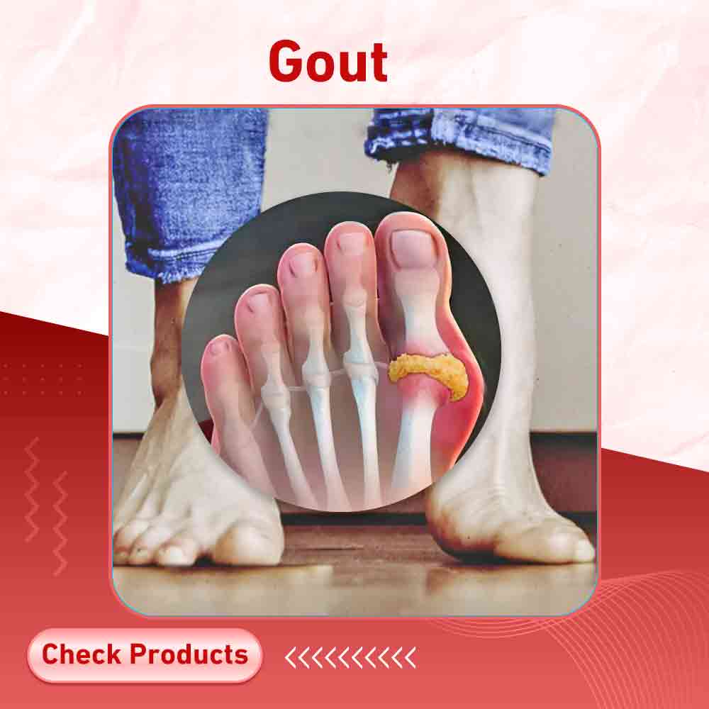 gout - Milano Pharmacy